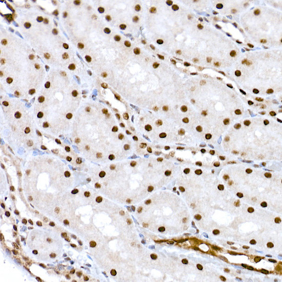 Phospho-CREB (Ser133) Antibody in Immunohistochemistry (Paraffin) (IHC (P))