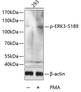 Phospho-ERK3 (Ser189) Antibody in Western Blot (WB)