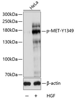 Phospho-c-Met (Tyr1349) Antibody in Western Blot (WB)