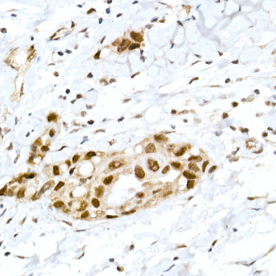 Phospho-Rb (Ser795) Antibody in Immunohistochemistry (Paraffin) (IHC (P))