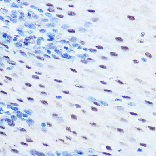 Phospho-STAT1 (Ser727) Antibody in Immunohistochemistry (Paraffin) (IHC (P))