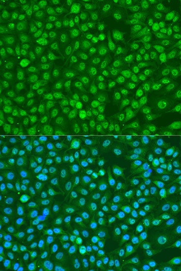 Phospho-BRCA1 (Ser1423) Antibody in Immunocytochemistry (ICC/IF)