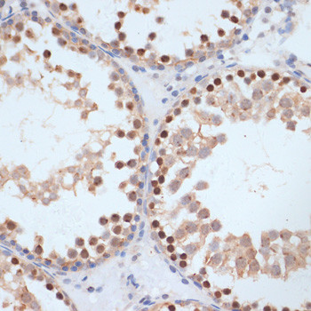 Phospho-BRCA1 (Ser1423) Antibody in Immunohistochemistry (Paraffin) (IHC (P))