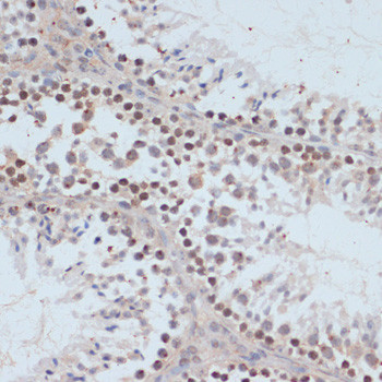 Phospho-BRCA1 (Ser1423) Antibody in Immunohistochemistry (Paraffin) (IHC (P))