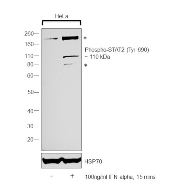 Phospho-STAT2 (Tyr690) Antibody in Western Blot (WB)