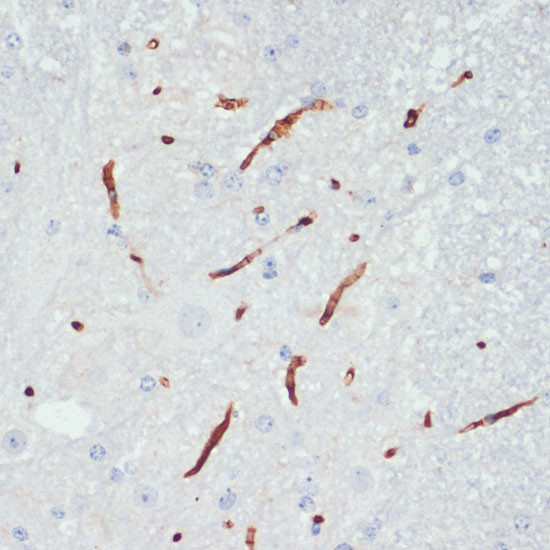 Phospho-eNOS (Ser1177) Antibody in Immunohistochemistry (Paraffin) (IHC (P))