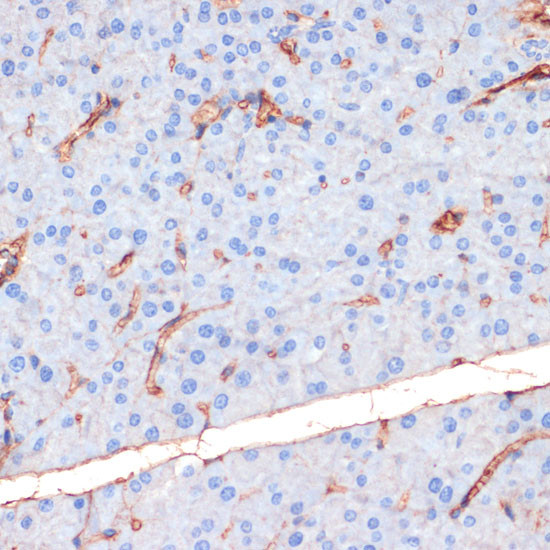 Phospho-eNOS (Ser1177) Antibody in Immunohistochemistry (Paraffin) (IHC (P))