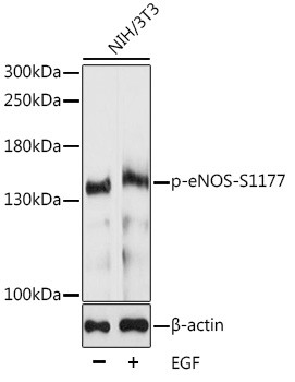 Phospho-eNOS (Ser1177) Antibody in Western Blot (WB)