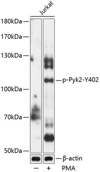 Phospho-PYK2 (Tyr402) Antibody in Western Blot (WB)