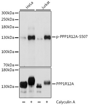 Phospho-MYPT1 (Ser507) Antibody in Western Blot (WB)