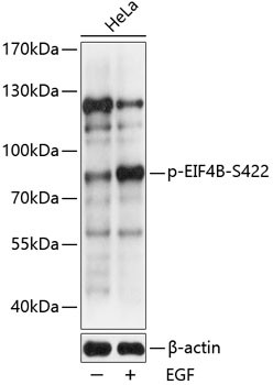 Phospho-eIF4B (Ser422) Antibody in Western Blot (WB)