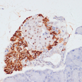 Phospho-ATP Citrate Lyase (Ser455) Antibody in Immunohistochemistry (Paraffin) (IHC (P))