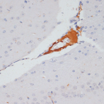 Phospho-ATP Citrate Lyase (Ser455) Antibody in Immunohistochemistry (Paraffin) (IHC (P))