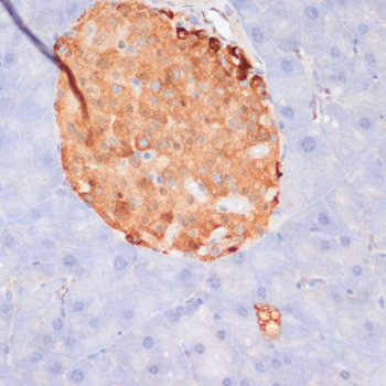 Phospho-ATP Citrate Lyase (Ser455) Antibody in Immunohistochemistry (Paraffin) (IHC (P))