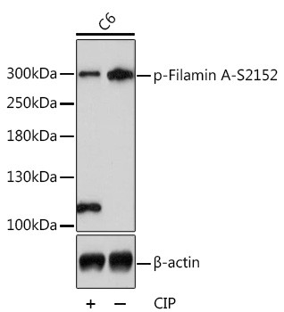 Phospho-Filamin A (Ser2152) Antibody in Western Blot (WB)