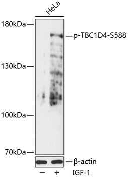 Phospho-AS160 (Ser588) Antibody in Western Blot (WB)