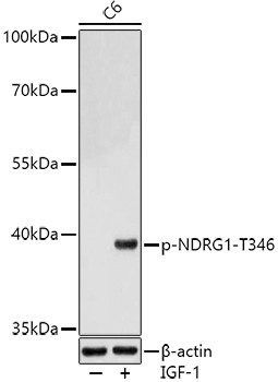 Phospho-NDRG1 (Thr346) Antibody in Western Blot (WB)