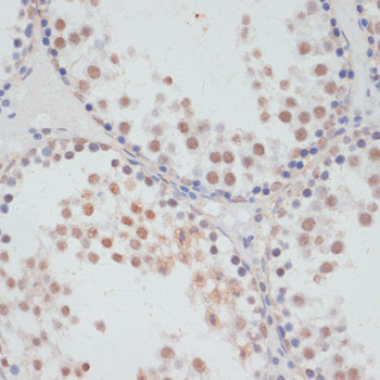 Phospho-MSK1 (Ser376) Antibody in Immunohistochemistry (Paraffin) (IHC (P))