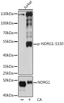 Phospho-NDRG1 (Ser330) Antibody in Western Blot (WB)