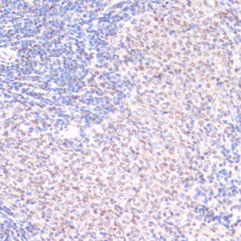 Phospho-SRF (Ser103) Antibody in Immunohistochemistry (Paraffin) (IHC (P))