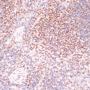 Phospho-SRF (Ser103) Antibody in Immunohistochemistry (Paraffin) (IHC (P))