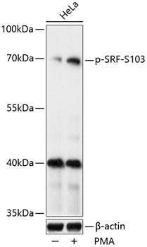 Phospho-SRF (Ser103) Antibody in Western Blot (WB)