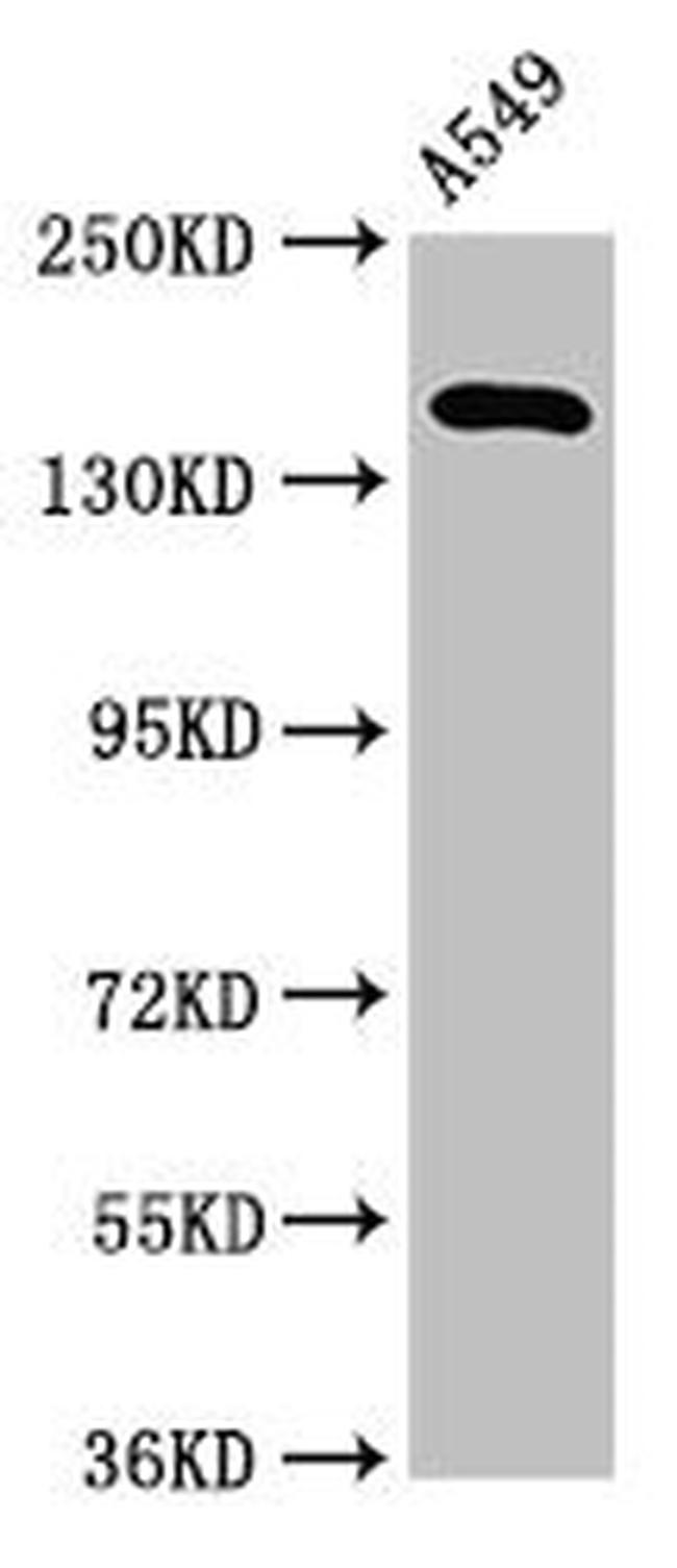 A2ML1 Antibody in Western Blot (WB)