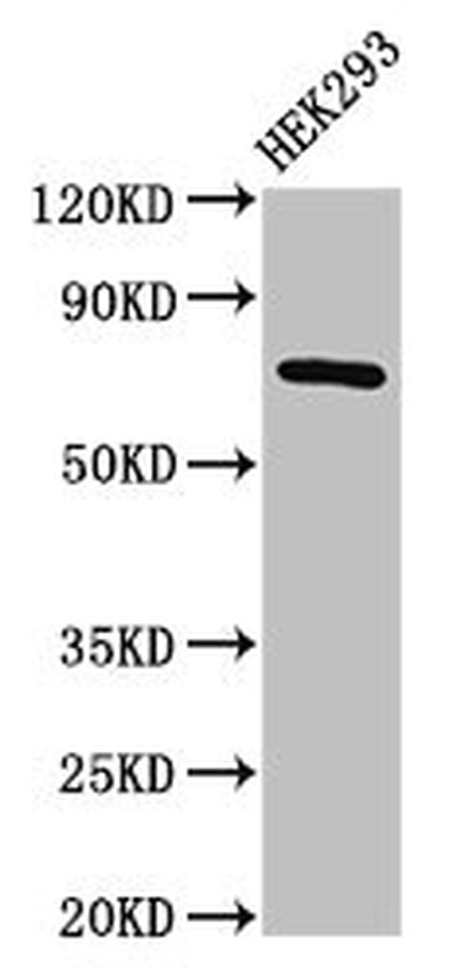 AACS Antibody in Western Blot (WB)