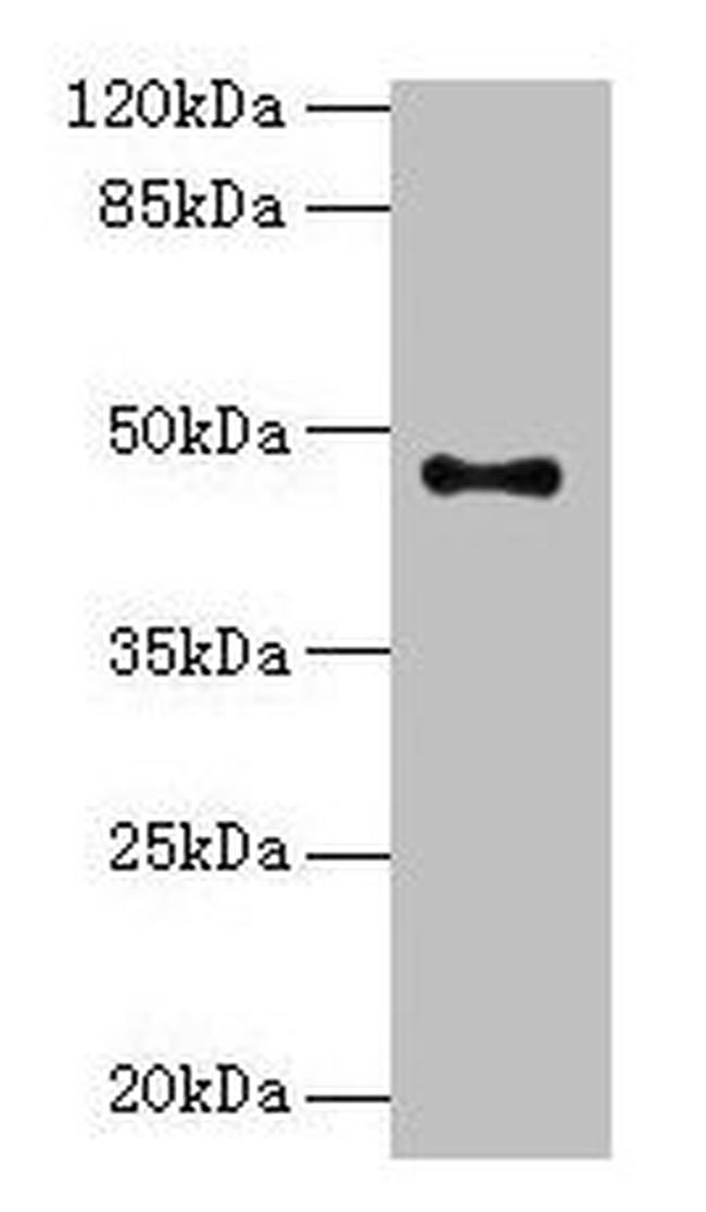 AADACL2 Antibody in Western Blot (WB)