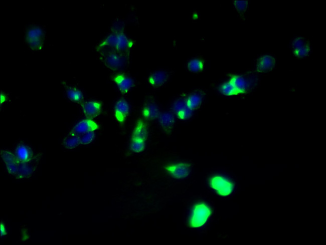 ABHD2 Antibody in Immunocytochemistry (ICC/IF)