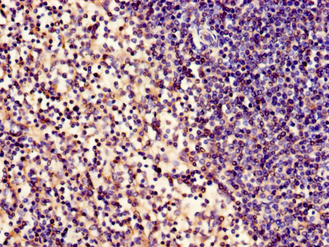 ABHD2 Antibody in Immunohistochemistry (Paraffin) (IHC (P))