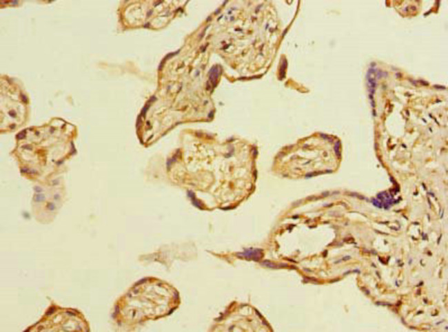 ABHD2 Antibody in Immunohistochemistry (Paraffin) (IHC (P))