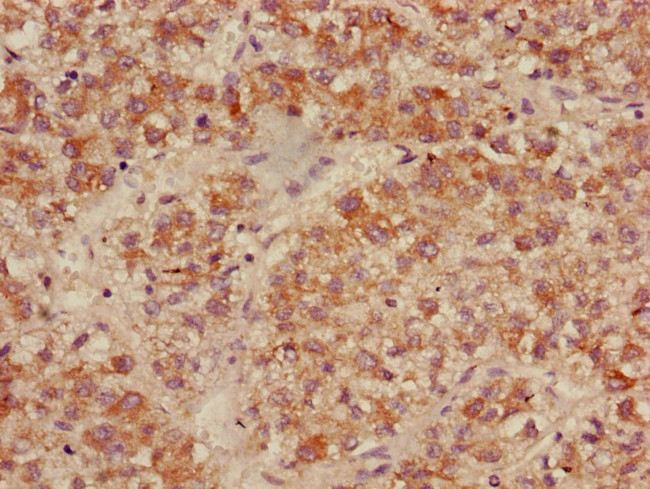 ACADL Antibody in Immunohistochemistry (Paraffin) (IHC (P))