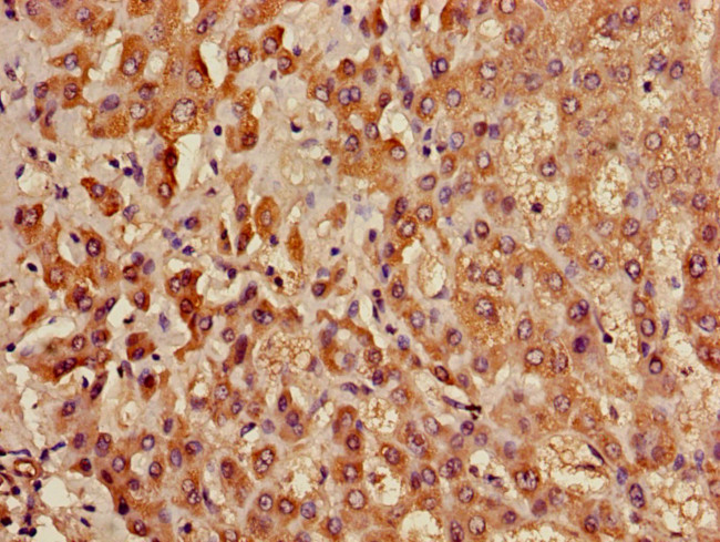 ACADL Antibody in Immunohistochemistry (Paraffin) (IHC (P))