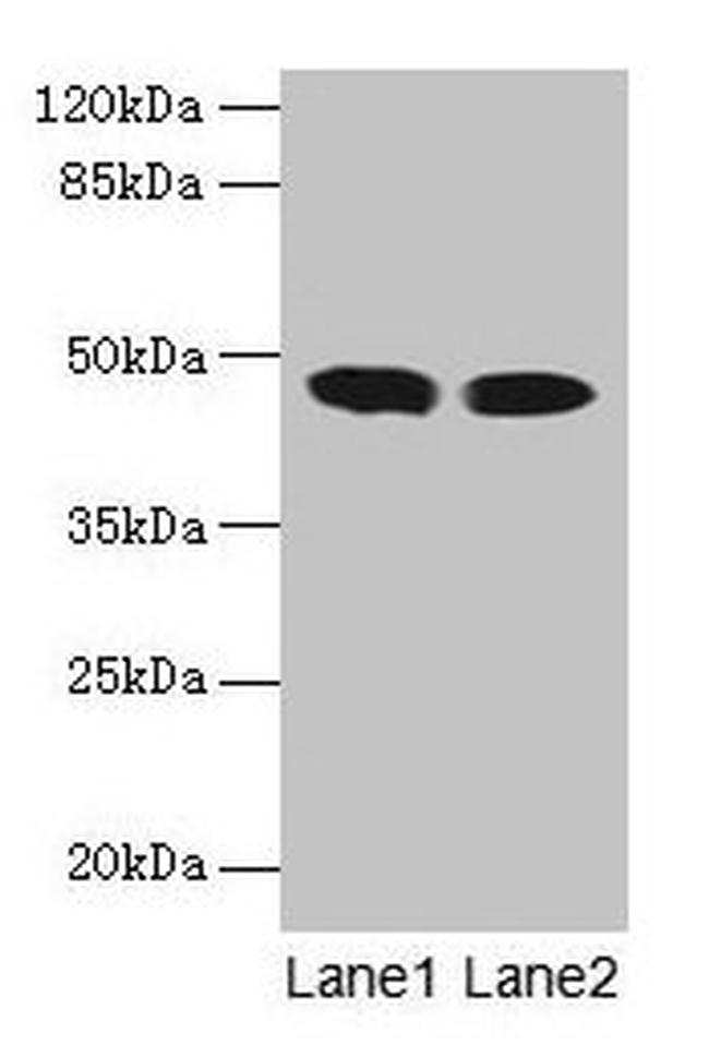 ACADL Antibody in Western Blot (WB)