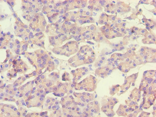 ACADS Antibody in Immunohistochemistry (Paraffin) (IHC (P))