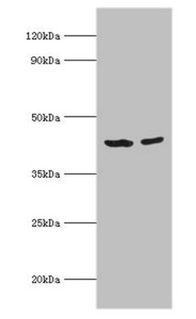 ACADS Antibody in Western Blot (WB)