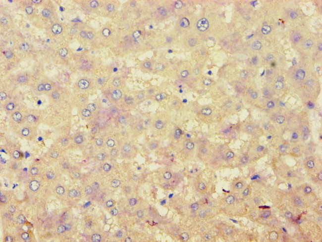 ACAT1 Antibody in Immunohistochemistry (Paraffin) (IHC (P))