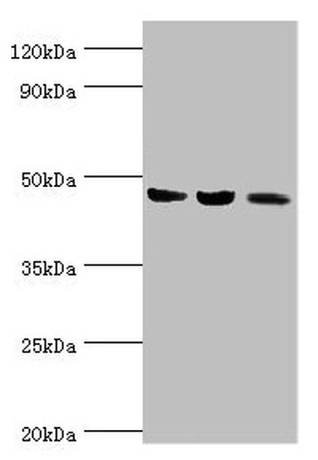 ACAT1 Antibody in Western Blot (WB)