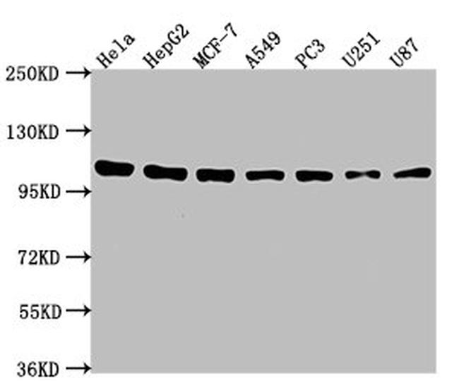 alpha Actinin 1 Antibody in Western Blot (WB)