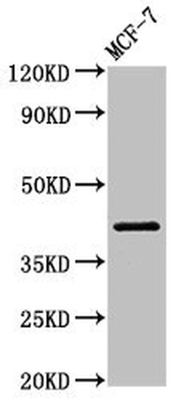 ACTR1A Antibody in Western Blot (WB)