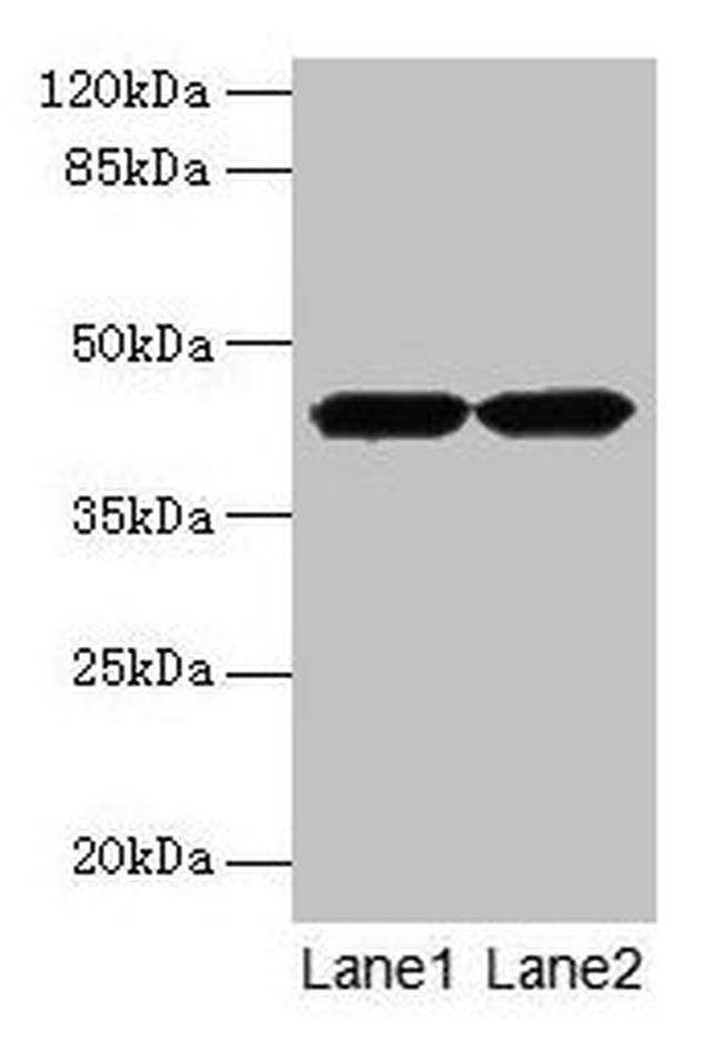 ACTRT2 Antibody in Western Blot (WB)