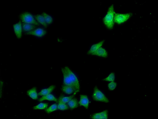 ADH7 Antibody in Immunocytochemistry (ICC/IF)