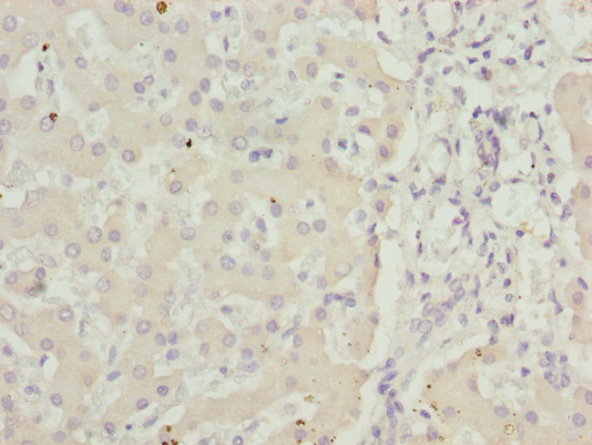 ADPGK Antibody in Immunohistochemistry (Paraffin) (IHC (P))