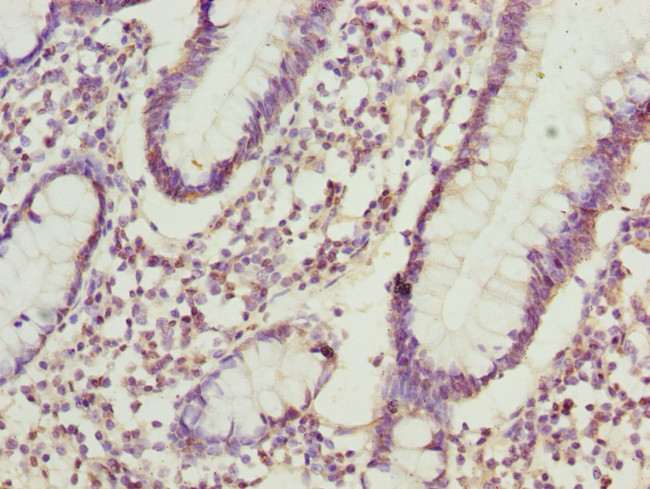 ADPGK Antibody in Immunohistochemistry (Paraffin) (IHC (P))