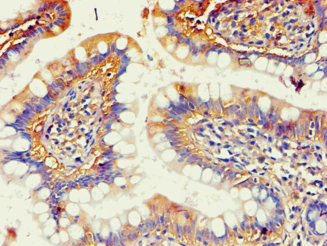 AKR1B10 Antibody in Immunohistochemistry (Paraffin) (IHC (P))