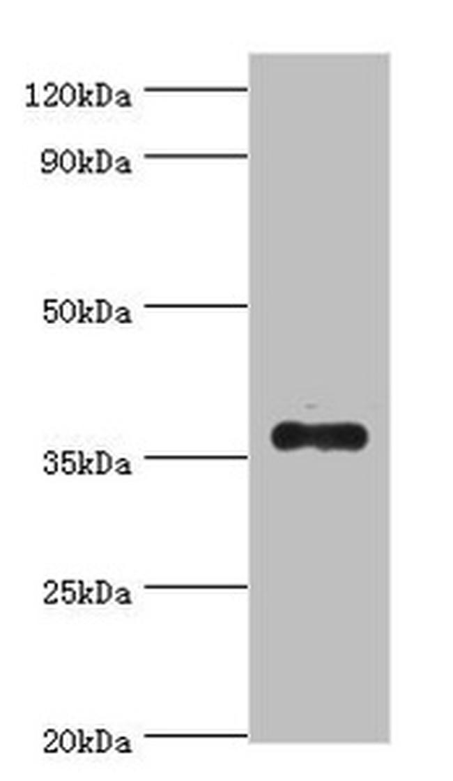 AKR1B10 Antibody in Western Blot (WB)