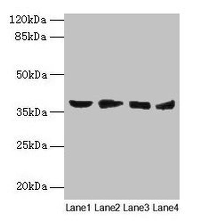 AKR1C2 Antibody in Western Blot (WB)