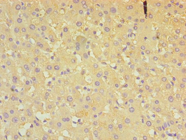 ALDH4A1 Antibody in Immunohistochemistry (Paraffin) (IHC (P))