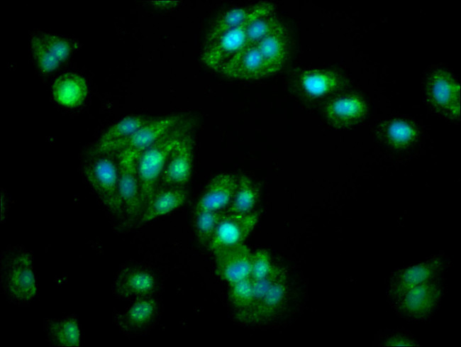 ALDH5A1 Antibody in Immunocytochemistry (ICC/IF)